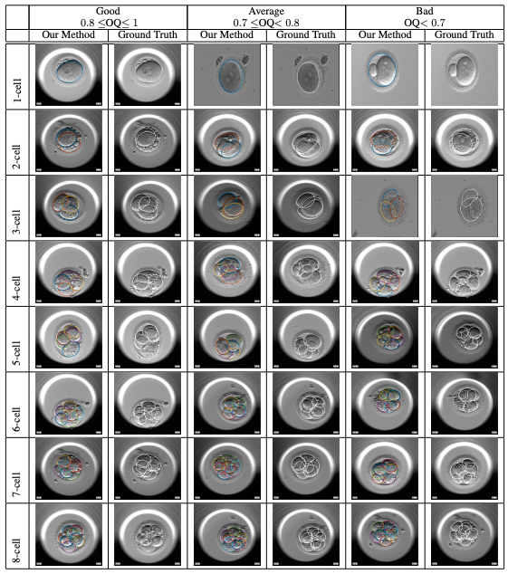 Preimplantation Blastomere Boundary Identification in HMC Microscopic Images of Early Stage Human Embryos | Shakiba