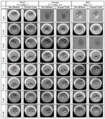 Preimplantation Blastomere Boundary Identification in HMC Microscopic Images of Early Stage Human Embryos