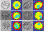 Human blastocyst segmentation using neural network